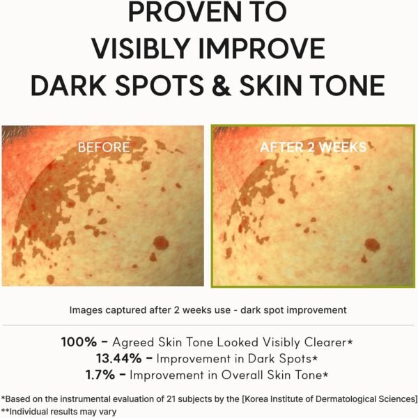 Arencia Vitamin C Booster Shot Serum with Glutathione, Niacinamide and Vitamin E for Dark Spot Care, Fine Lines & Wrinkles, Glass Skin, Korean Skincare 30ml/1.01 fl.oz  Amazon.ae Beauty - Scent : Unscented - Size : 30 ML - Image 7